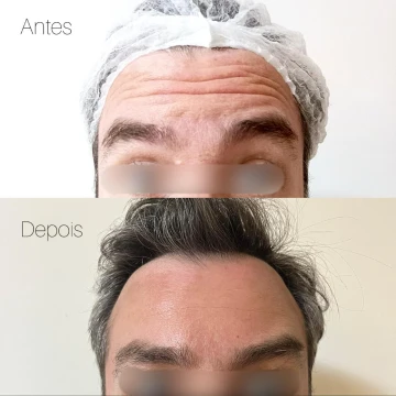 clinicavitoria_antesdepois10