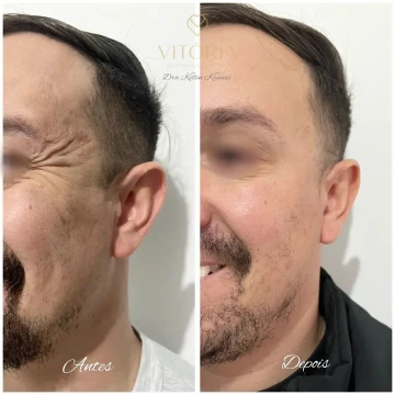 clinicavitoria_antesdepois3