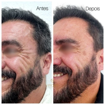 clinicavitoria_antesdepois5