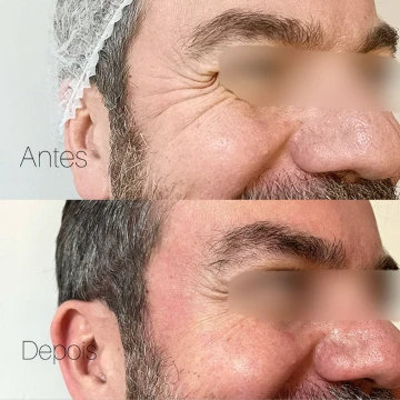 clinicavitoria_antesdepois7