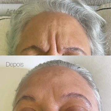 clinicavitoria_antesdepois8