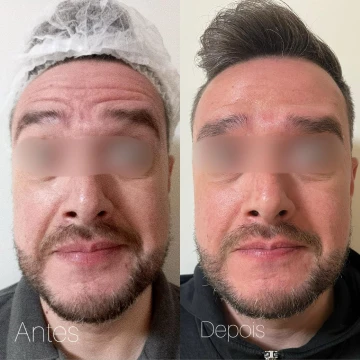 clinicavitoria_antesdepois9