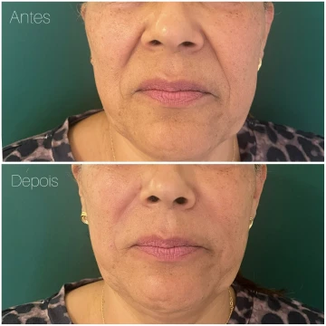 clinicavitoria_antes-depois_novos1