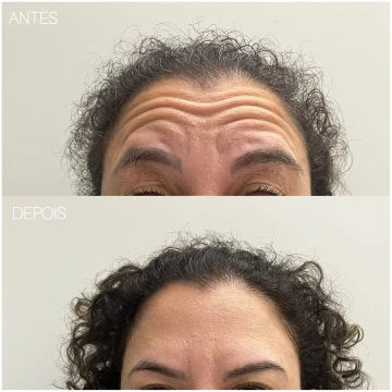 clinicavitoria_antes-depois_novos2