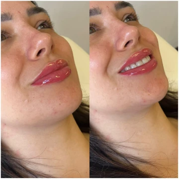 clinicavitoria_antes-depois_novos3